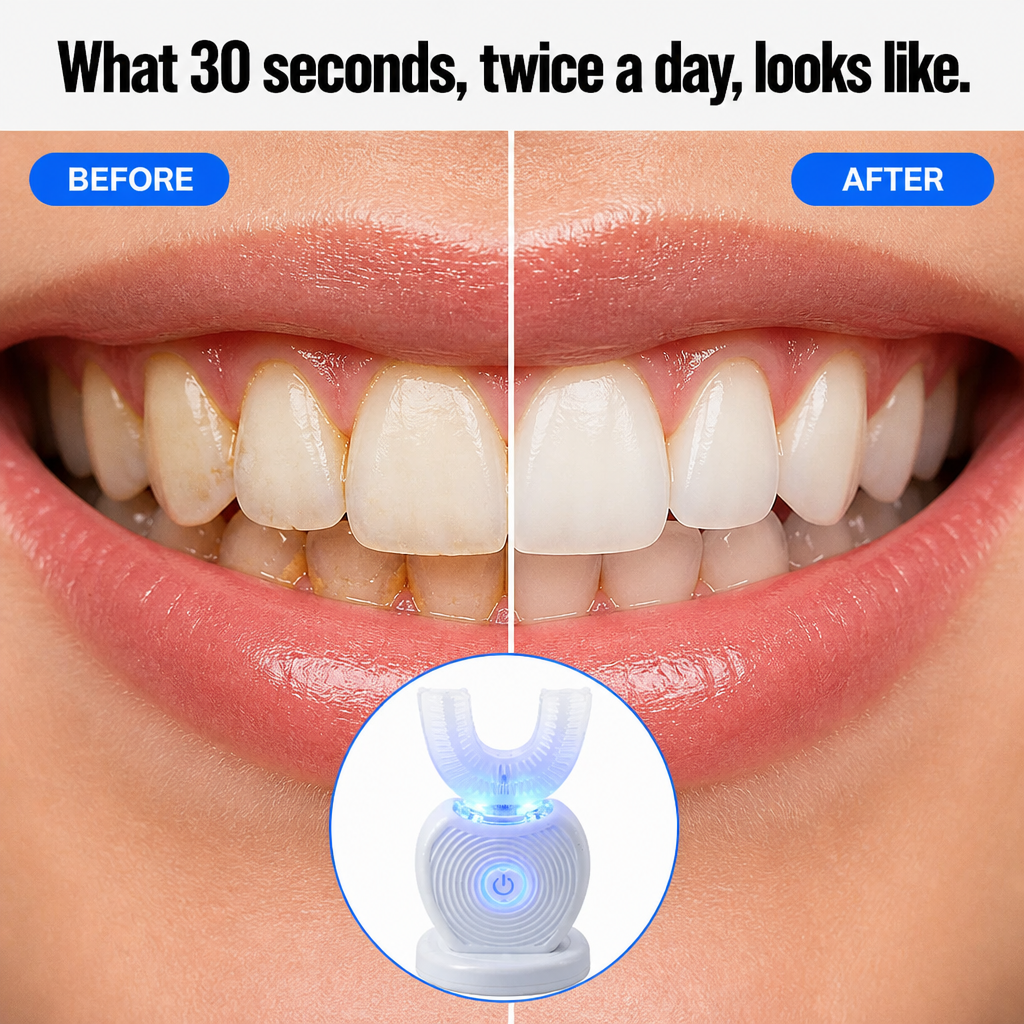 SonicBeam™ Complete — Clean All Teeth Simultaneously in 30 Seconds Hands-Free