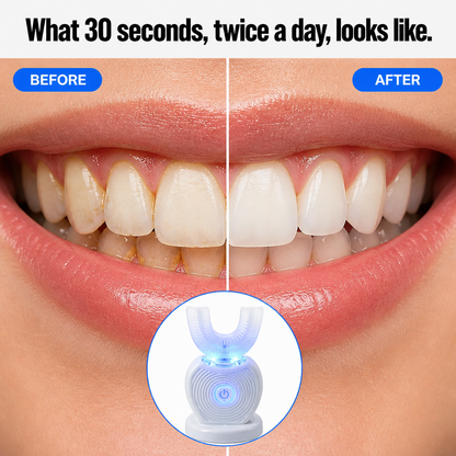 SonicBeam™ Complete — Clean All Teeth Simultaneously in 30 Seconds Hands-Free