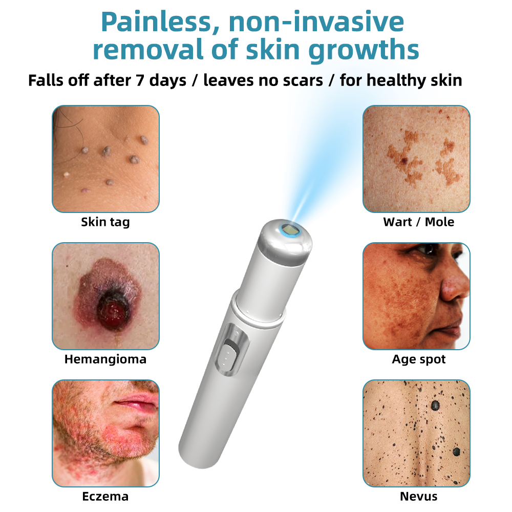LuminaraTouch™ — Effortless Laser Precision for Radiant, Flawless Skin Fast