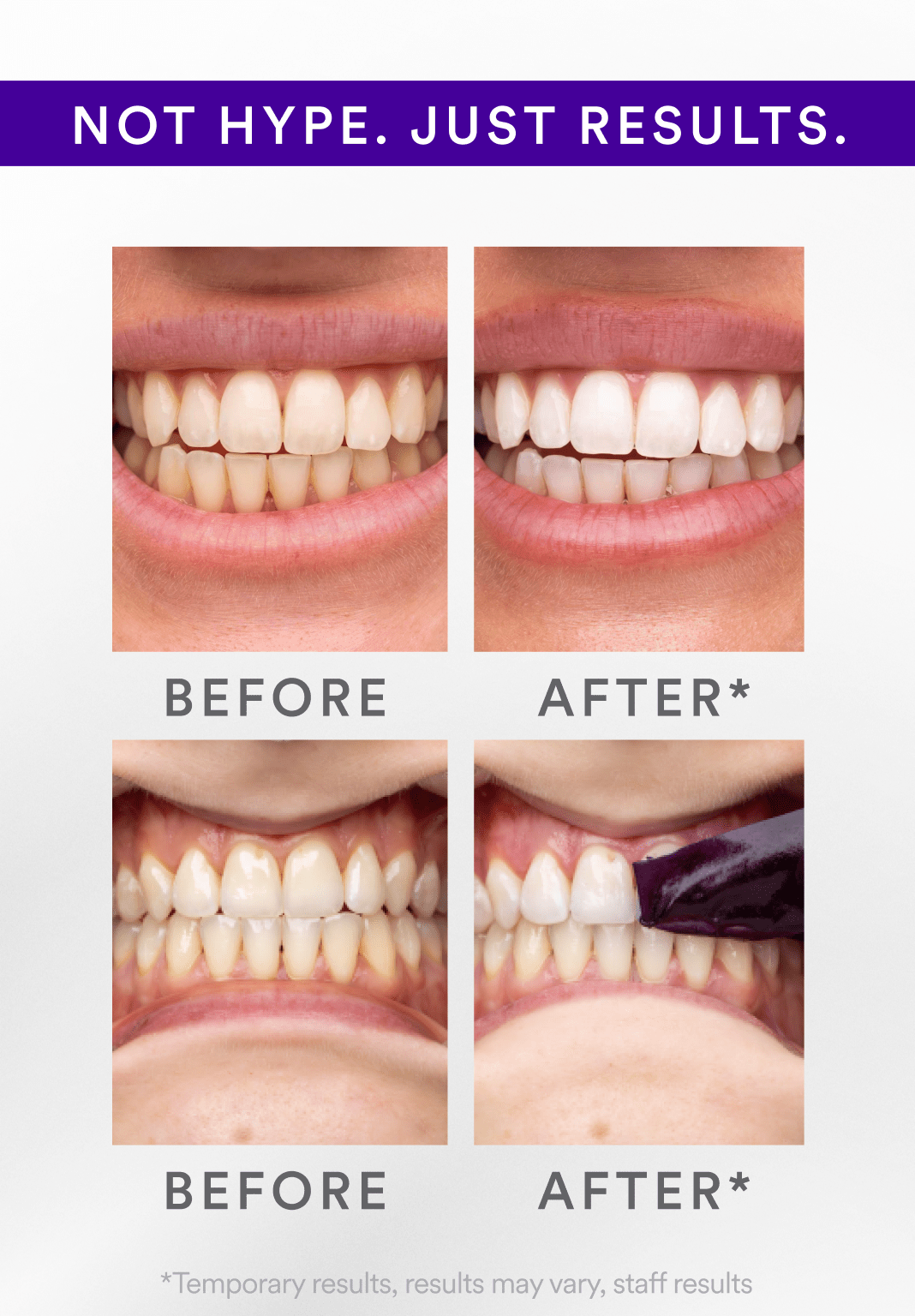 GlareGlow™ — Reveal a Brilliant Smile That Commands Attention Every Time