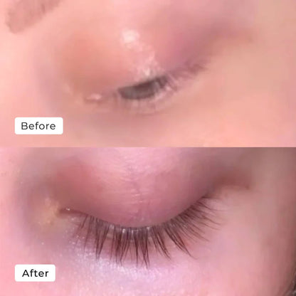 BUY 1 GET 1 FREE | Kaylash Growth Serum