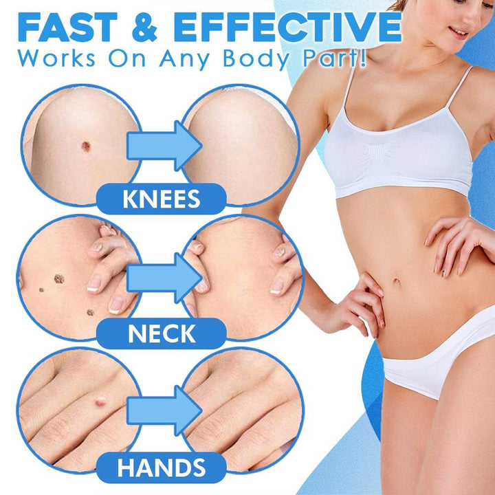 Dermaclear™ — Quickly Reveal Smooth, Tag-Free Skin Without Pain or Scars