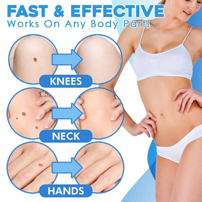 Dermaclear™ — Quickly Reveal Smooth, Tag-Free Skin Without Pain or Scars