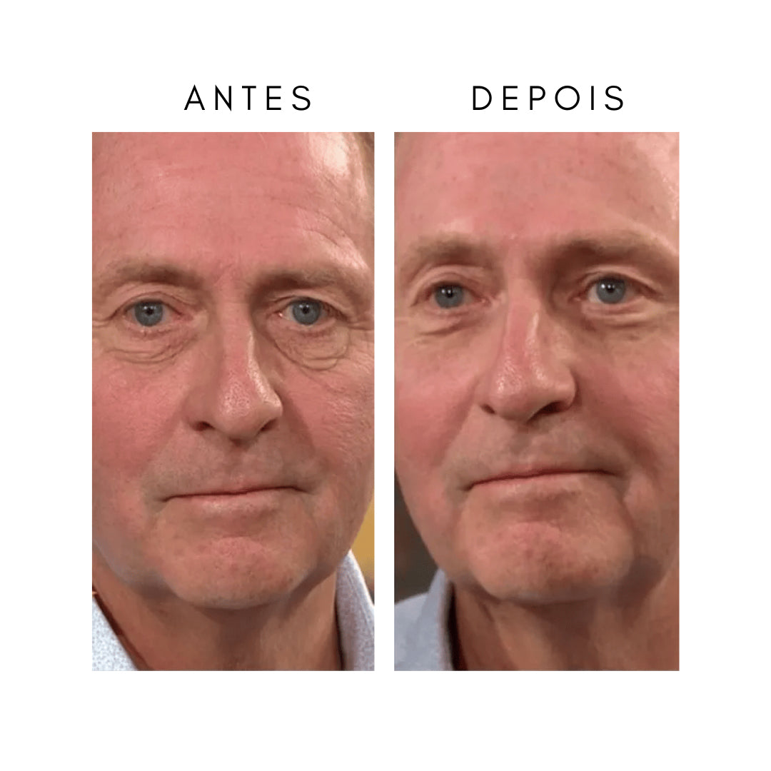 LumaRise™ Eye Renewal Cream — Wake Up to Instantly Younger, Brighter Eyes That Dazzle Every Day