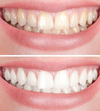 GlacialWhite™ — Unleash a Radiant Smile That Turns Heads Instantly