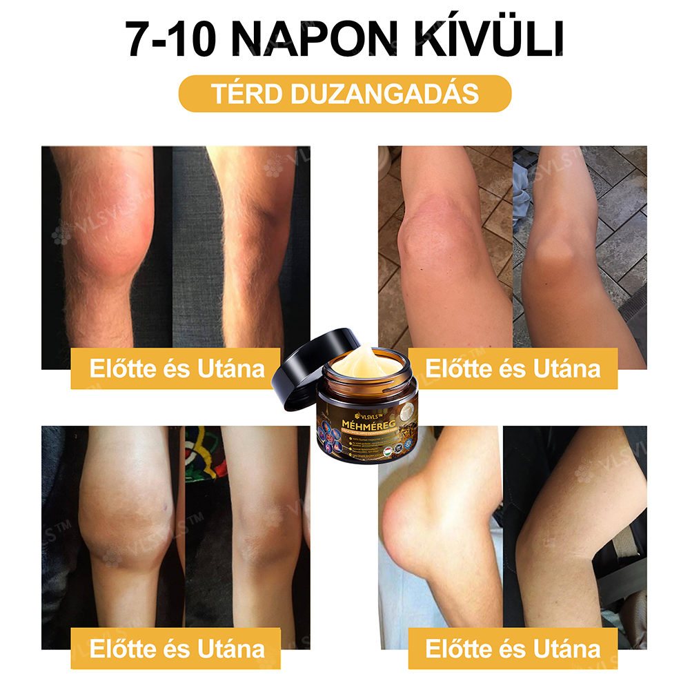 FlexuraBalm™ — Unlock Rapid Relief and Move Freely Again Without Pain or Stiffness