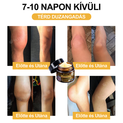 FlexuraBalm™ — Unlock Rapid Relief and Move Freely Again Without Pain or Stiffness