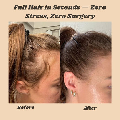 VoluStrand™ — Instantly Fills Thinning Hair for a Full, Natural Look | 1+1 FREE