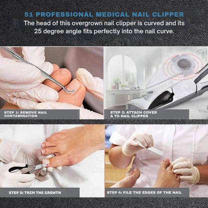 TriForma™ Nail Clipper — Master Thick, Painful Nails with Pinpoint Precision and Comfort