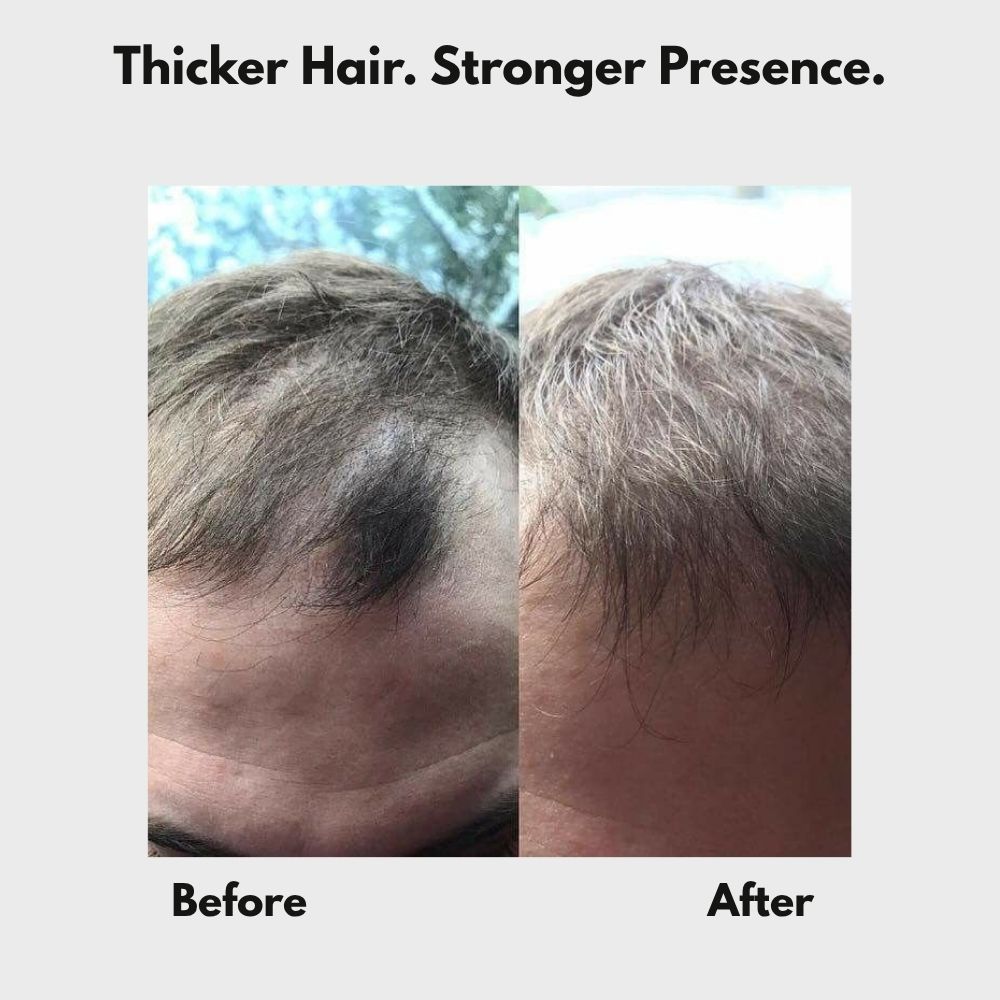 FluffUp™ — Instantly Conceals Hair Loss for a Fuller, Younger Look | Now 50% OFF + Ships Free