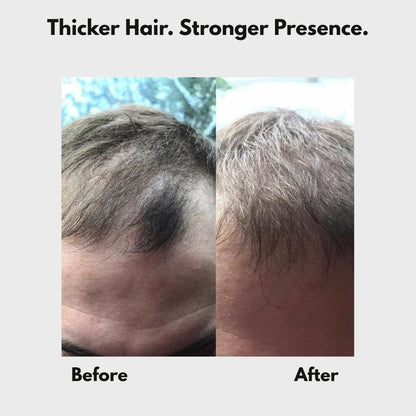 FluffUp™ — Instantly Conceals Hair Loss for a Fuller, Younger Look | Now 50% OFF + Ships Free