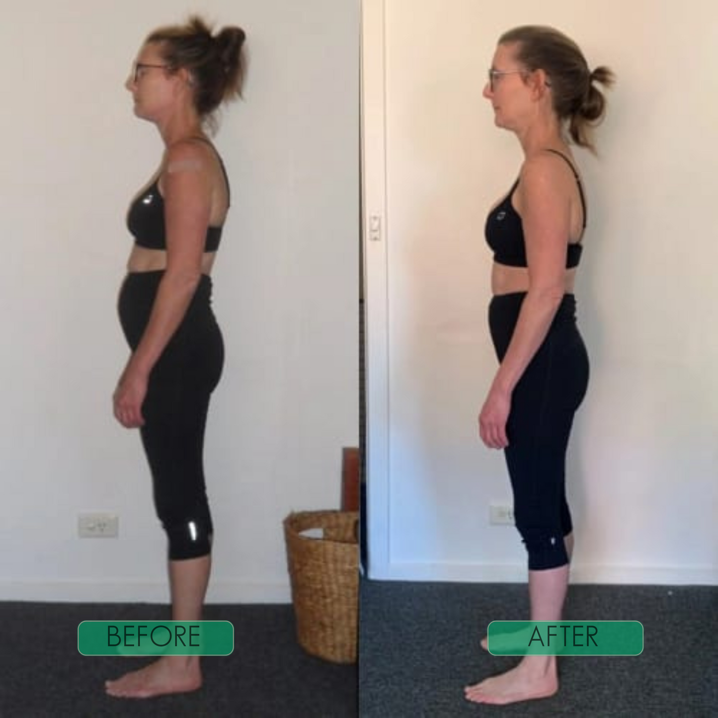 VeriAlign™ — Instantly Unlock Your Natural, Pain-Free Confidence