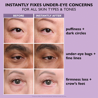 LumiFlect™ — Instantly Lift and Illuminate Eyes to Look Youthfully Awake All Day