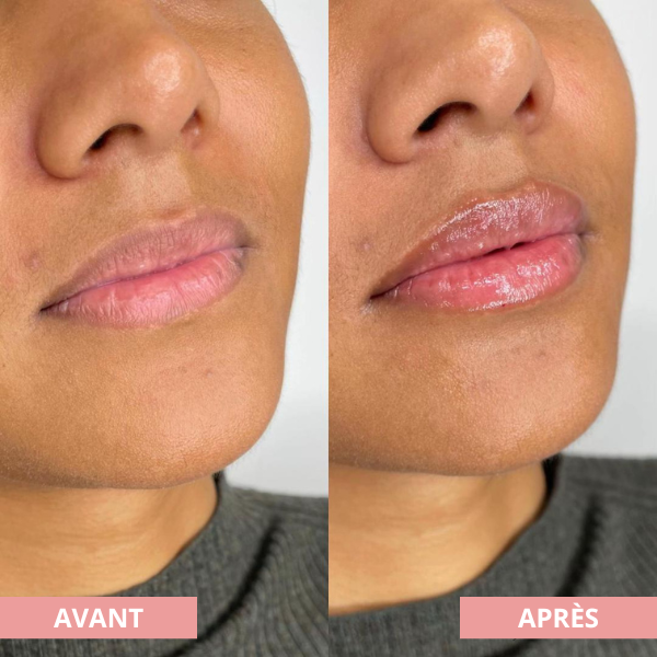 Arvilaro | Kit Ritual Lips - Thicker & Shiny lips in minutes