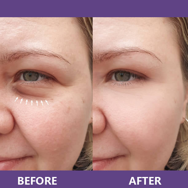 ViviLuxe™ Radiance Eye Cream — Reveal Bright, Youthful Eyes That Command Attention