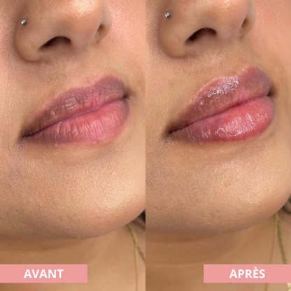 Arvilaro | Kit Ritual Lips - Thicker & Shiny lips in minutes