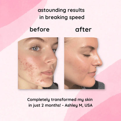 LumaLift™ Elixir Pads — Wake Up to Radiant, Silky Skin That Steals Every Glance