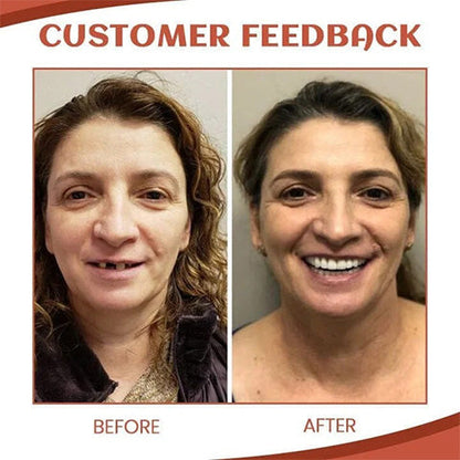 SiliconeAdjust | Silicone Set for Dentures