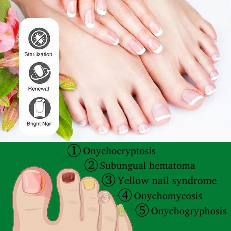 GingerWave™ — Reveal Stunning, Strong Nails That Boost Your Confidence Every Day