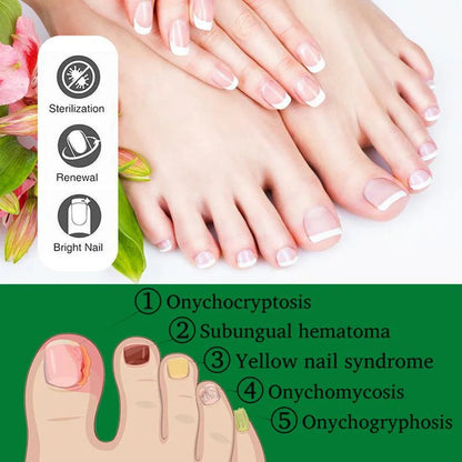 GingerWave™ — Reveal Stunning, Strong Nails That Boost Your Confidence Every Day