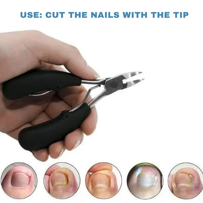 TriForma™ Nail Clipper — Master Thick, Painful Nails with Pinpoint Precision and Comfort