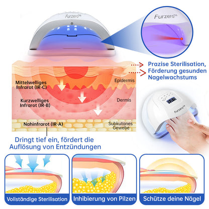 PureNail™ — Zap Nail Fungus Painlessly & Fast | 50% Off