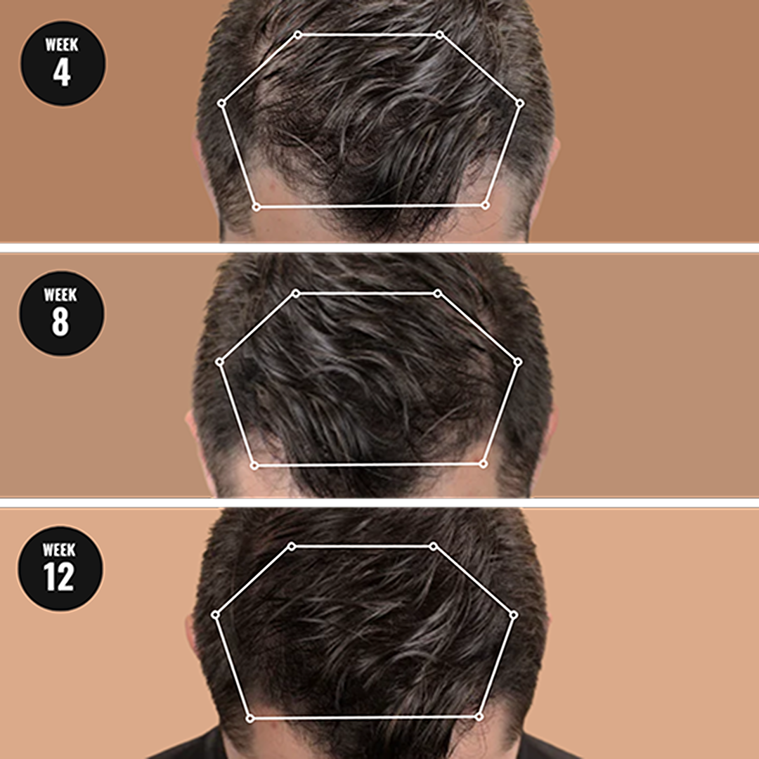 RootRevive™ — Thicker Hair Starts at the Roots | 50% Off
