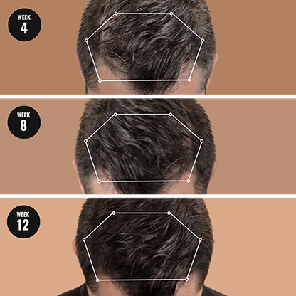 RootRevive™ — Thicker Hair Starts at the Roots | 50% Off