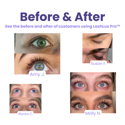 Final Day 1+1 FREE🔥 | LashLux Pro™ Lash Growth Serum