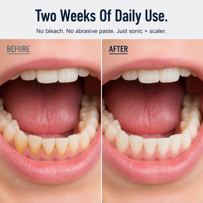 DentaVibe™ — Effortlessly Shatter Stubborn Tartar for a Radiant, Confident Smile