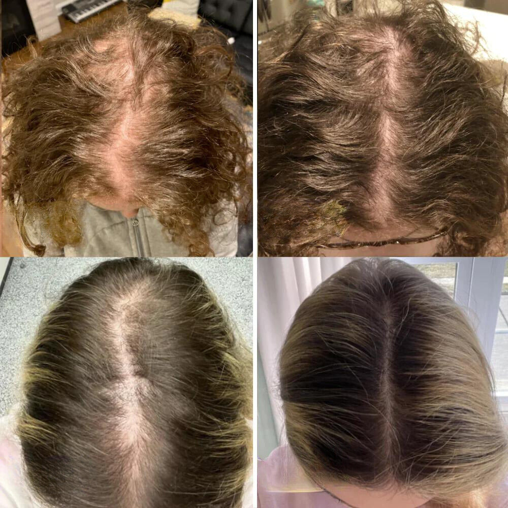 HerbaFleur™ — Unlock Bold, Lush Hair That Commands Every Room