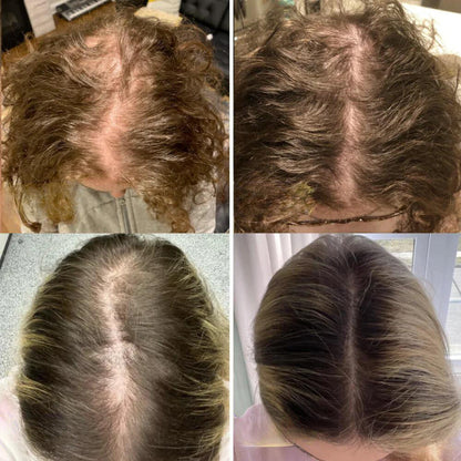 HerbaFleur™ — Unlock Bold, Lush Hair That Commands Every Room