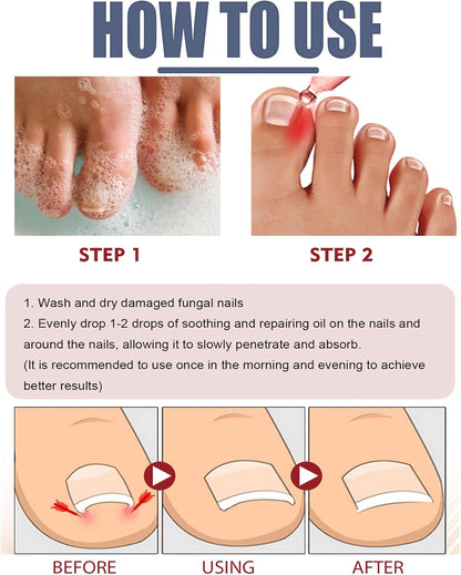 FungiFree| Treats toenails and fingernails