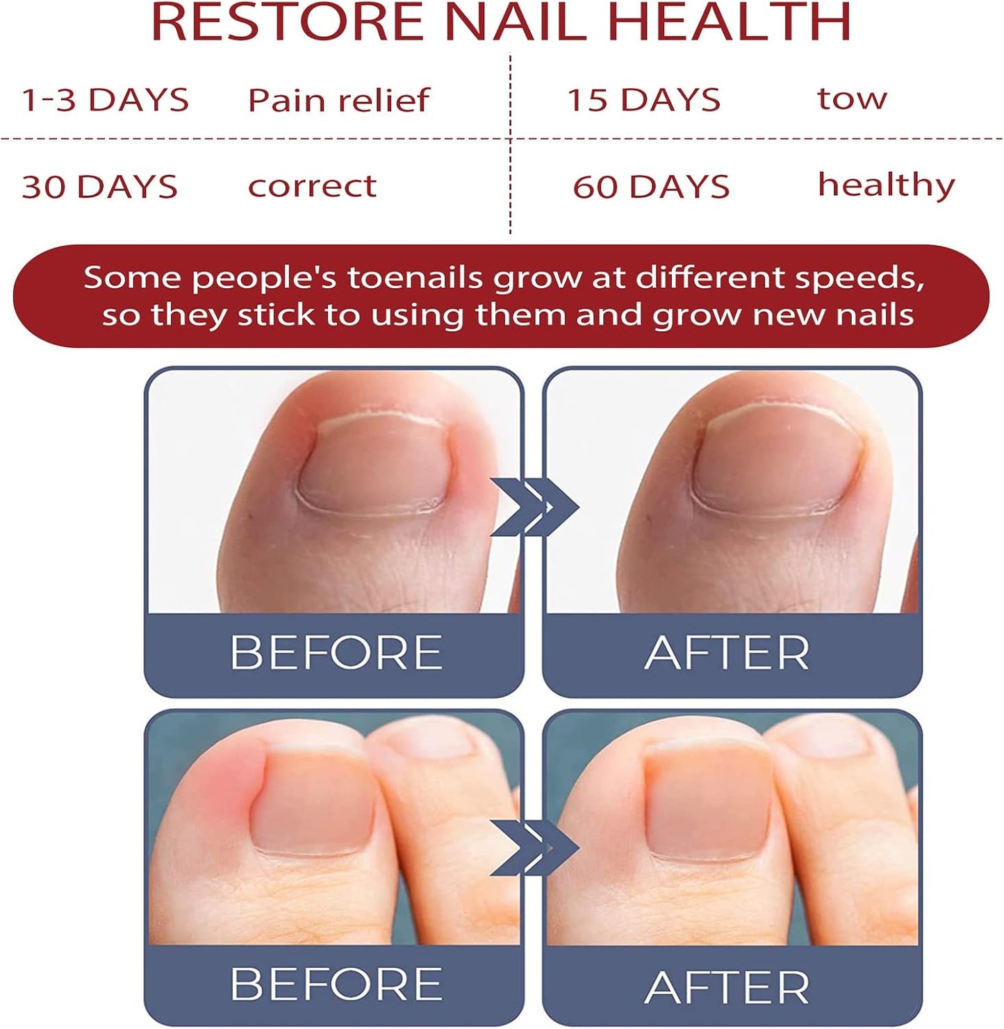 FungiFree| Treats toenails and fingernails