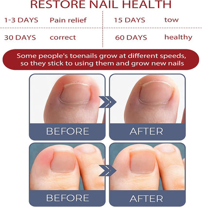 FungiFree| Treats toenails and fingernails
