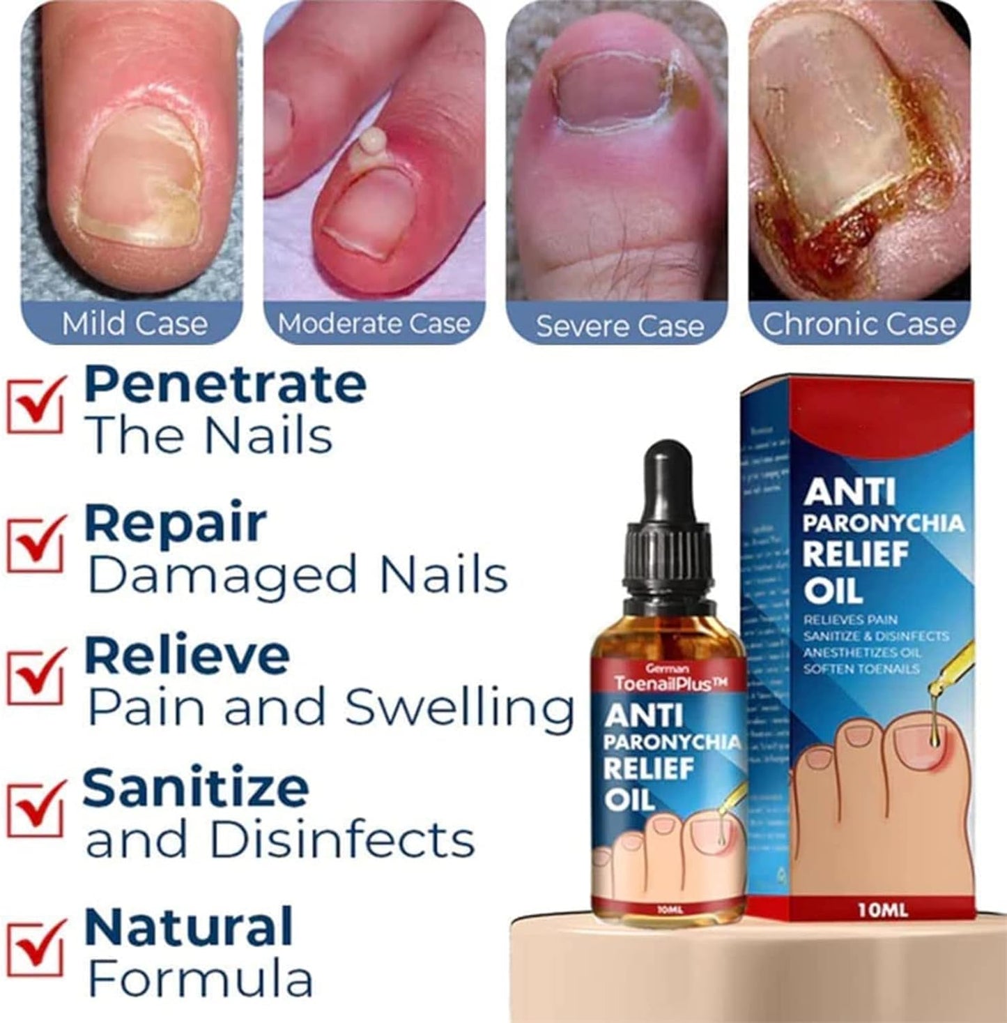 FungiFree| Treats toenails and fingernails