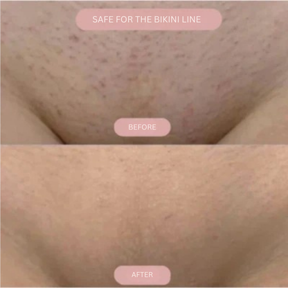 VeelaSmooth™ — Experience Blissful, Bump-Free Skin That Boosts Your Confidence Every Day
