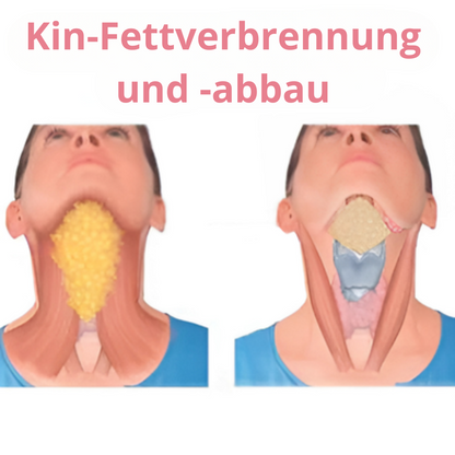 JawDefine™ Facial Sculptor - Eliminate Your Double Chin (Purchase 2, Receive 1 Free)
