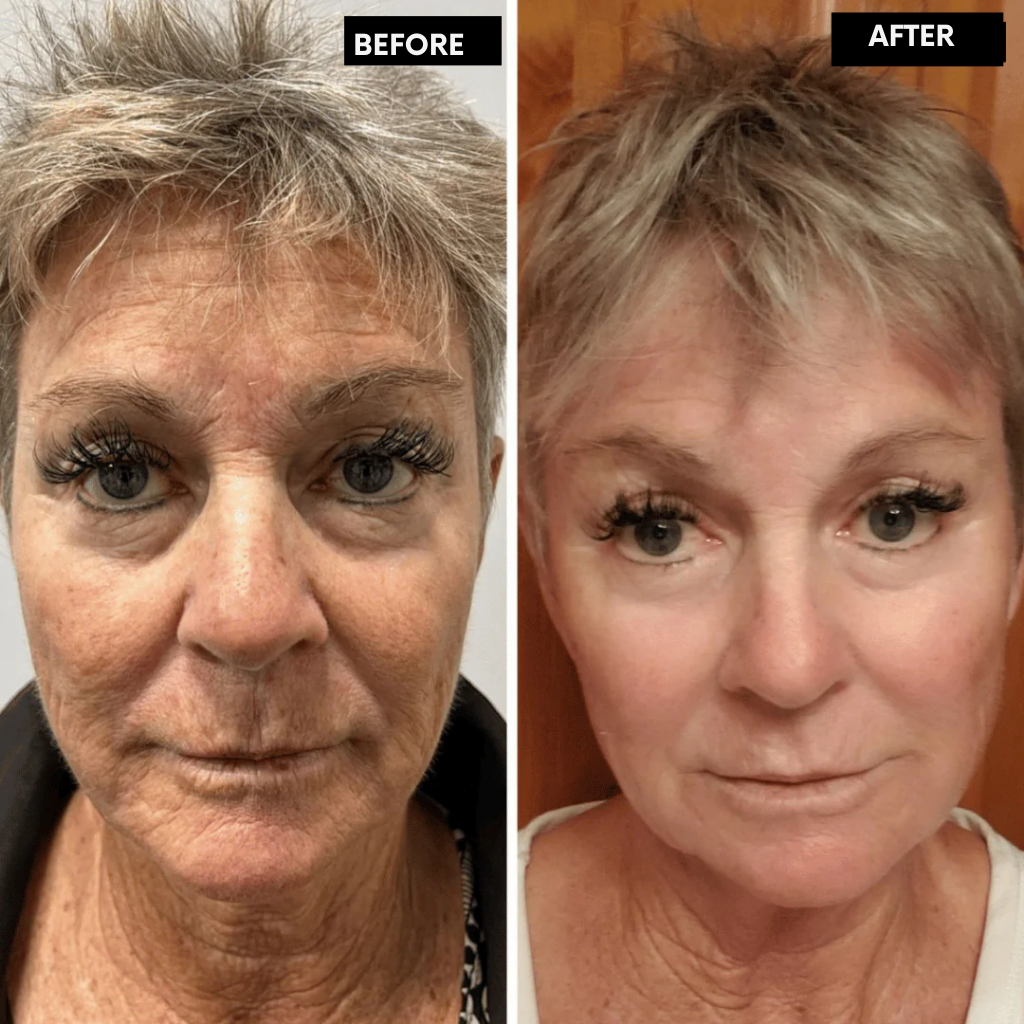 RadiantMuse™ — Reveal Youthful Glow and Smooth, Firm Skin in Just 14 Days
