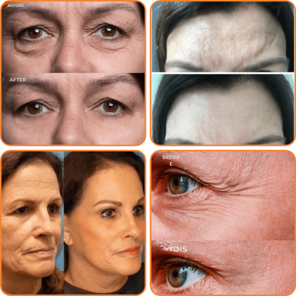 NovaLuxe™ Serum — Bounce Back Youthful, Radiant Skin in Days