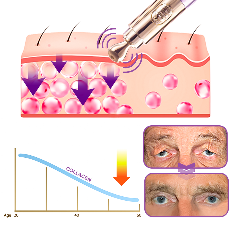 TheraPen™ Electric Serum Therapy Pen