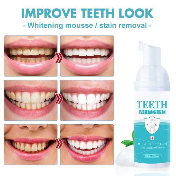 BrightSmile™ — Whiten Teeth Fast & Confident | 50% Off