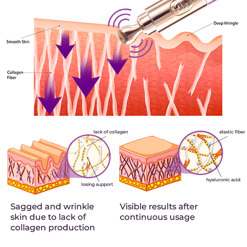TheraPen™ Electric Serum Therapy Pen