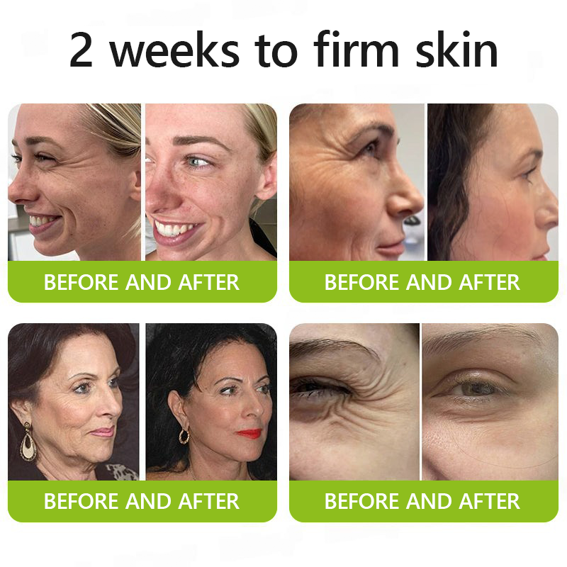 LuminaLift™ — Instantly Reveal Firmer, Brighter Skin That Turns Back Time Without Needles
