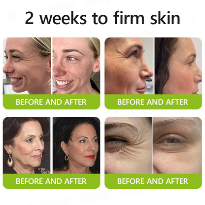 LuminaLift™ — Instantly Reveal Firmer, Brighter Skin That Turns Back Time Without Needles