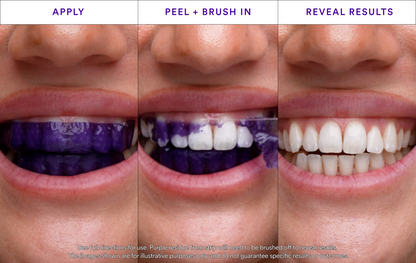 GlareGlow™ — Reveal a Brilliant Smile That Commands Attention Every Time