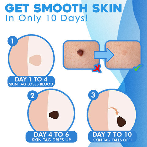 Dermaclear™ — Quickly Reveal Smooth, Tag-Free Skin Without Pain or Scars