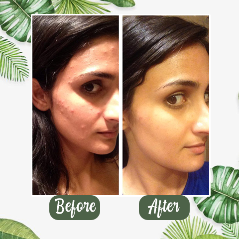 ZenovaGlow™ — Unleash Radiant, Head-Turning Skin Every Time You Swipe