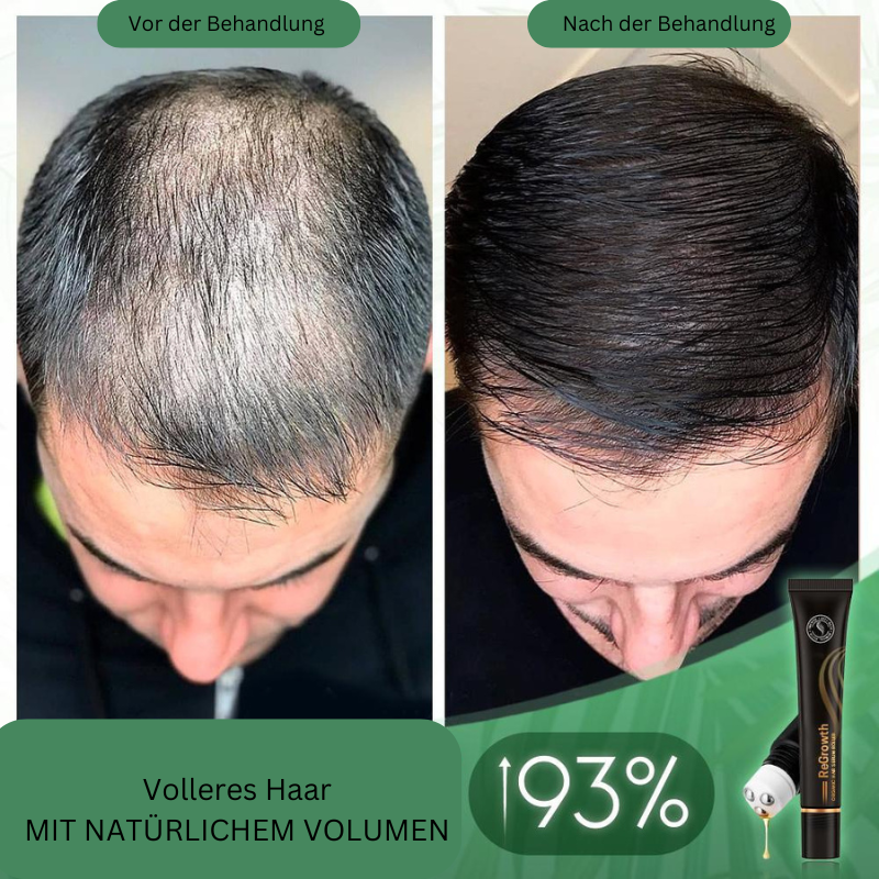 HairBoost™ Bio Hair Serum Roller (Purchase 1 Get 1 Free)
