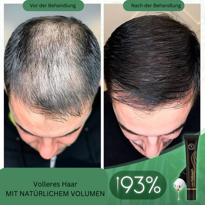 HairBoost™ Bio Hair Serum Roller (Purchase 1 Get 1 Free)